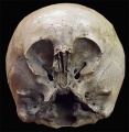 Starchild skull.jpg